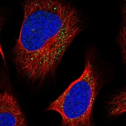 LIPT2 Antibody, Novus Biologicals 0.1mL; Unlabeled:Antibodies, Polyclonal